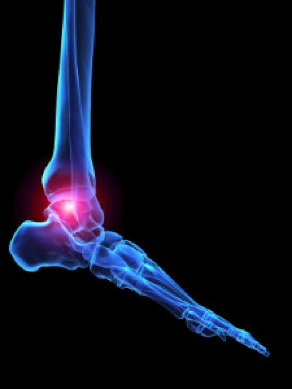 What Is Total Ankle Replacement Surgery?