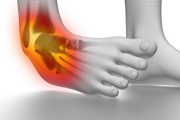 Risk Factors for Ankle Sprains and Strains