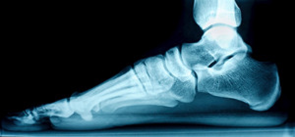 Adult Flat Feet and Their Underlying Causes